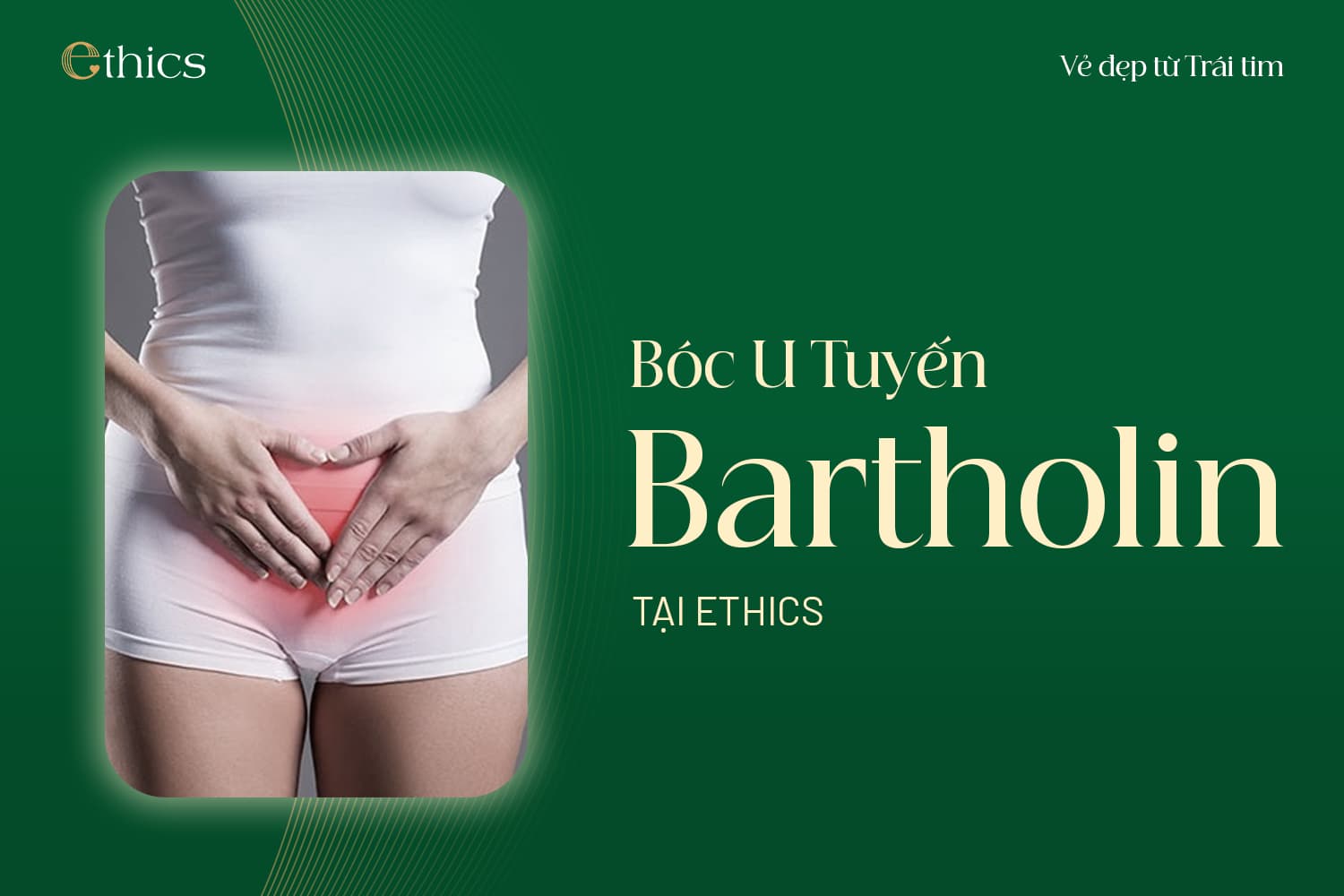 Pembedahan kista kelenjar Bartholin