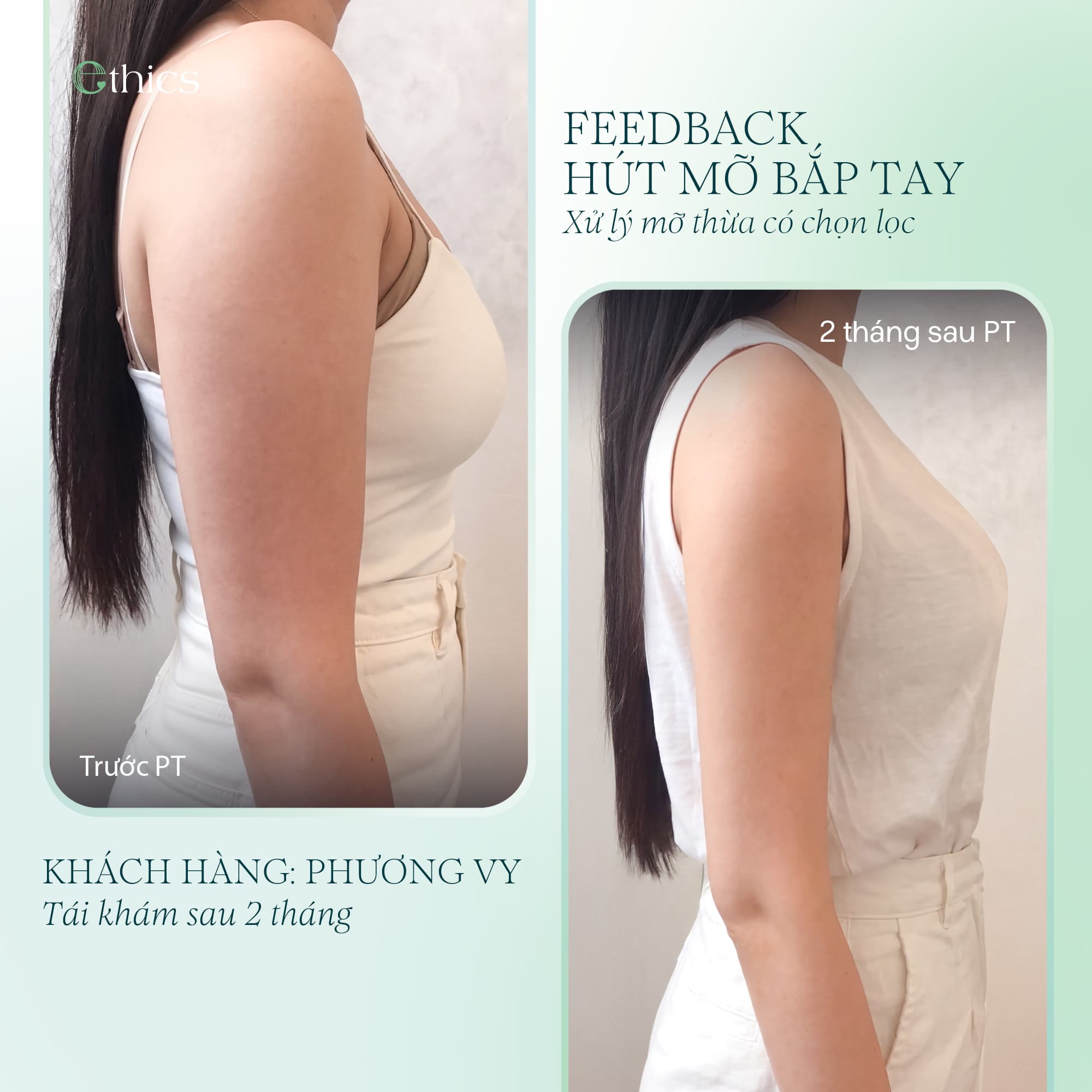 TINH GỌN BẮP TAY - TÔN LÊN ĐƯỜNG NÉT THANH THOÁT